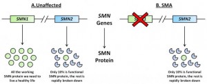 SMA gene 1 and 2 difference