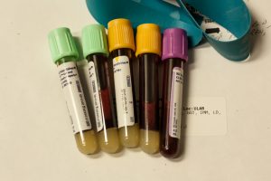 tubes of blood samples