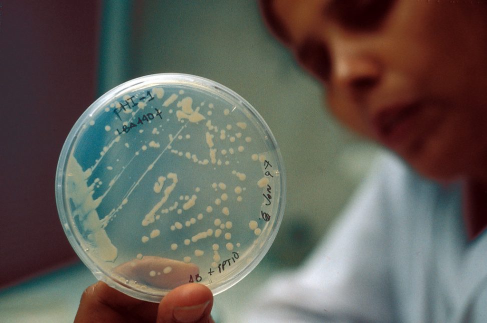 bacteria growing in Petri dish